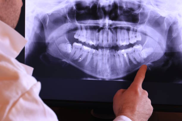 Best Emergency Root Canal Treatment in Logan, OH