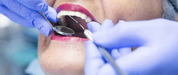 Best Emergency Dentist for Knocked-Out Tooth in Logan, OH